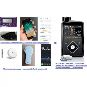 Консультации по установке системы искусственной поджелудочной железы