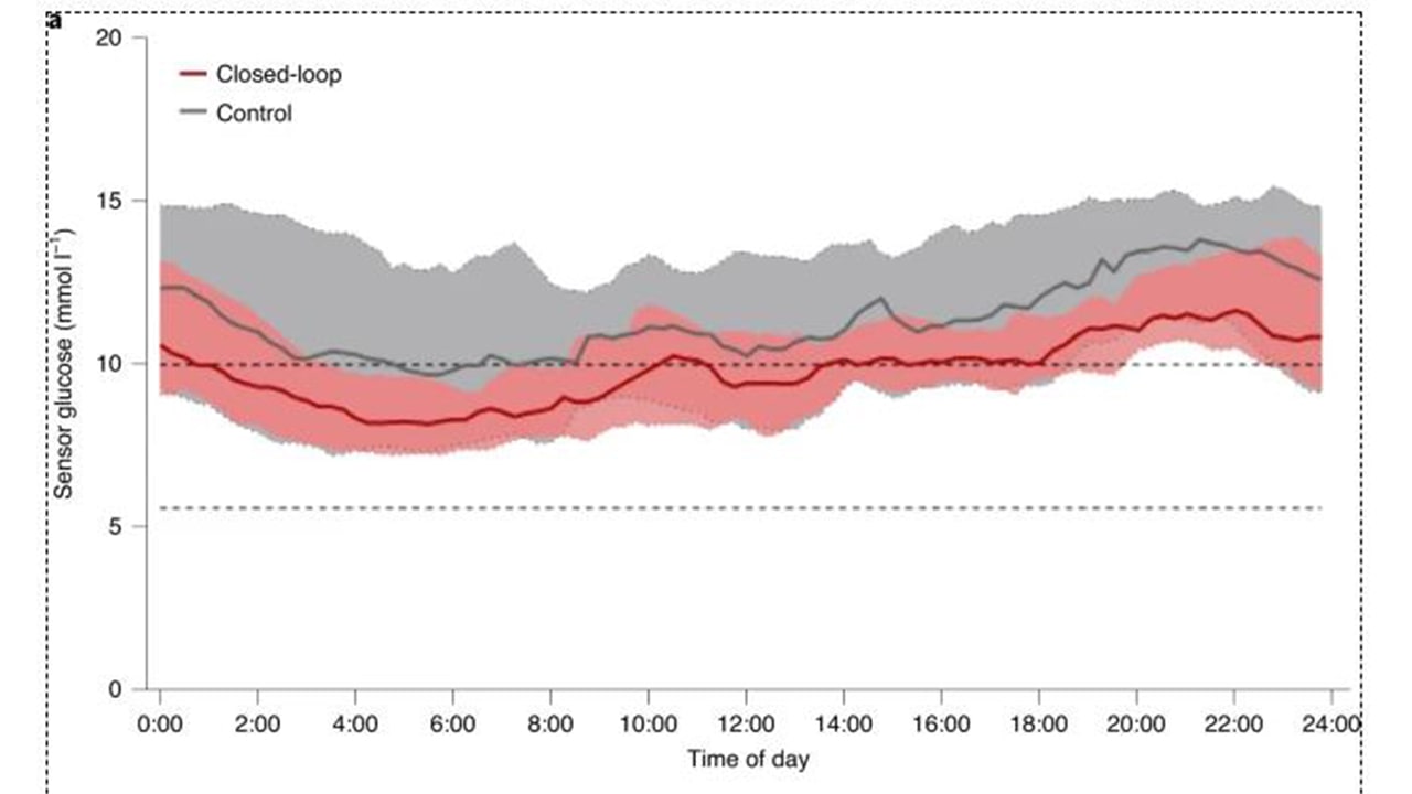 ипж эффективнее инсулинотерапии